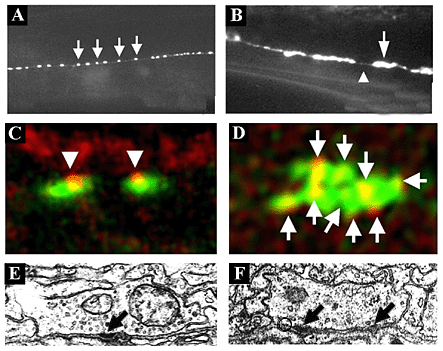 Figure 1: Synaptic defects in C. elegans rpm-1 mutants...